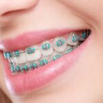 ORTHODONTICS